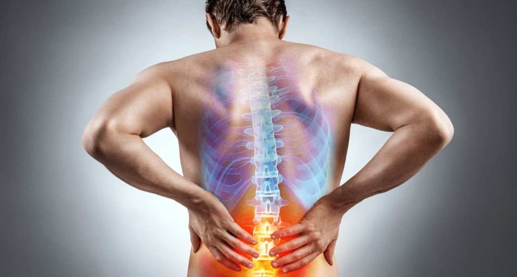 Sciatica — nerve root compression and leg pain illustration