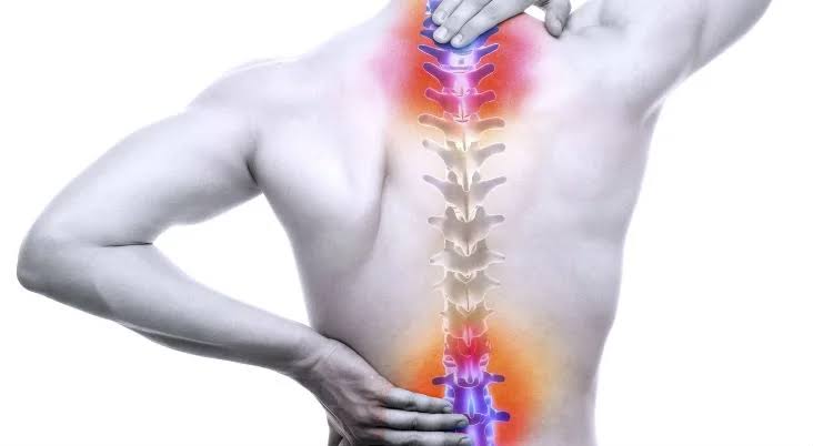 Lumbar spondylosis — degenerative disc disease illustration