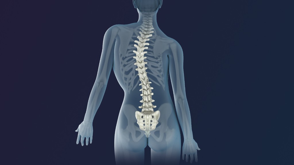 Scoliosis — lateral spinal curvature illustration